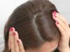 Make your hair dandruff free